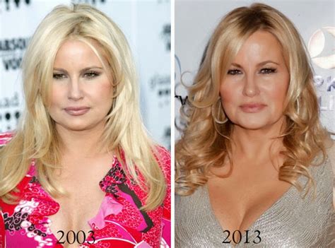 jennifer coolidge botox